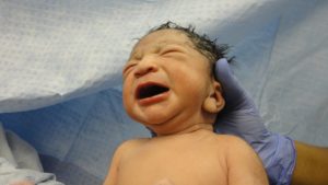 Natural Birth
