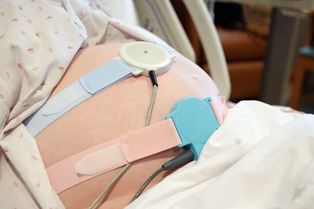 electronic fetal monitoring, birth injuries