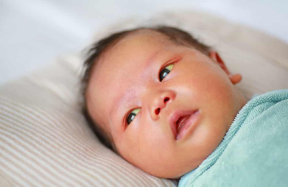 infant jaundice, kernicterus