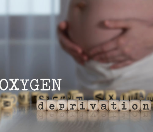 infant oxygen deprivation