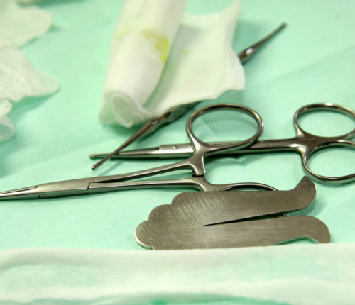 botched circumcision, medical malpractice