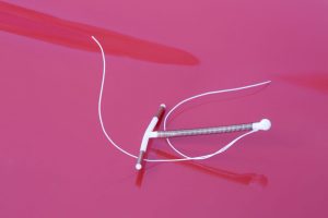 Essure