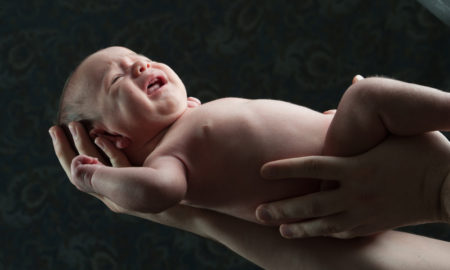 birth asphyxia, moro reflex, birth injuries