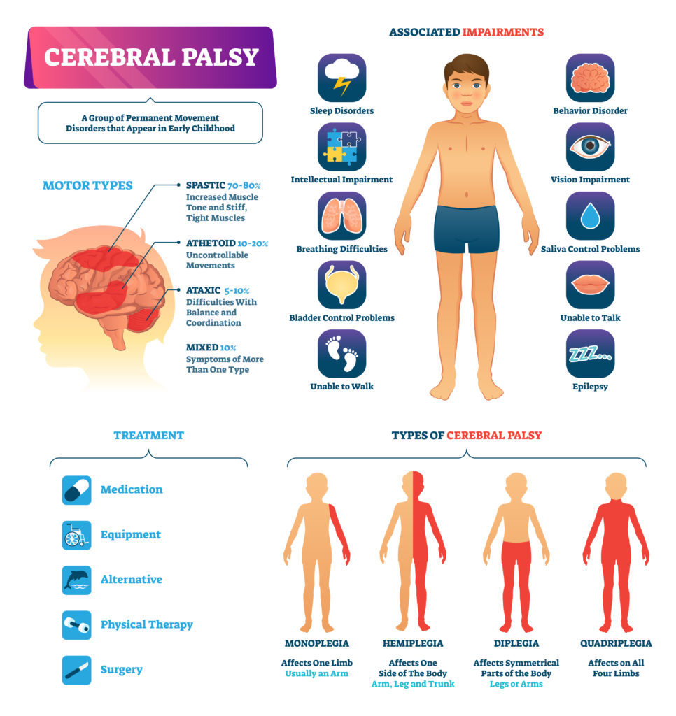 cerebral palsy, birth injury, brain damage