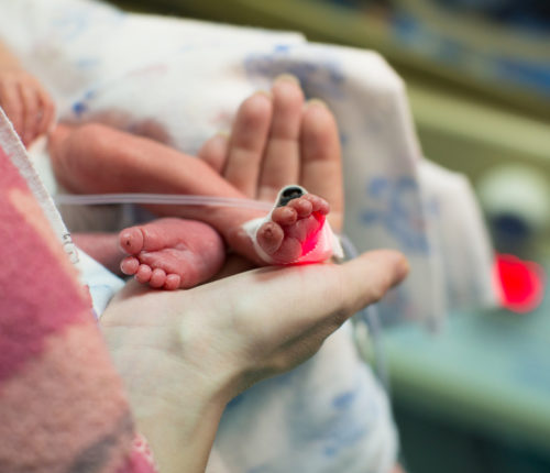 cerebral palsy, premature infants