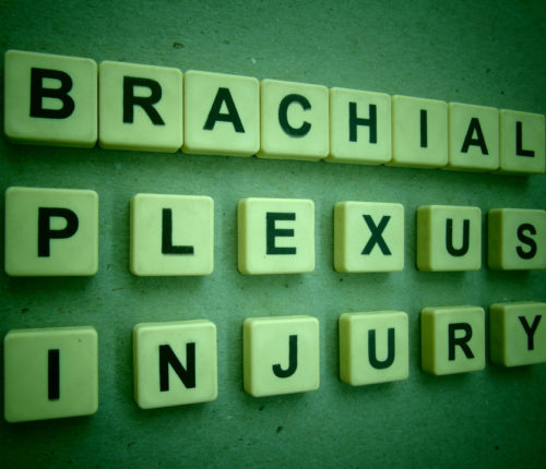 brachial plexus injury