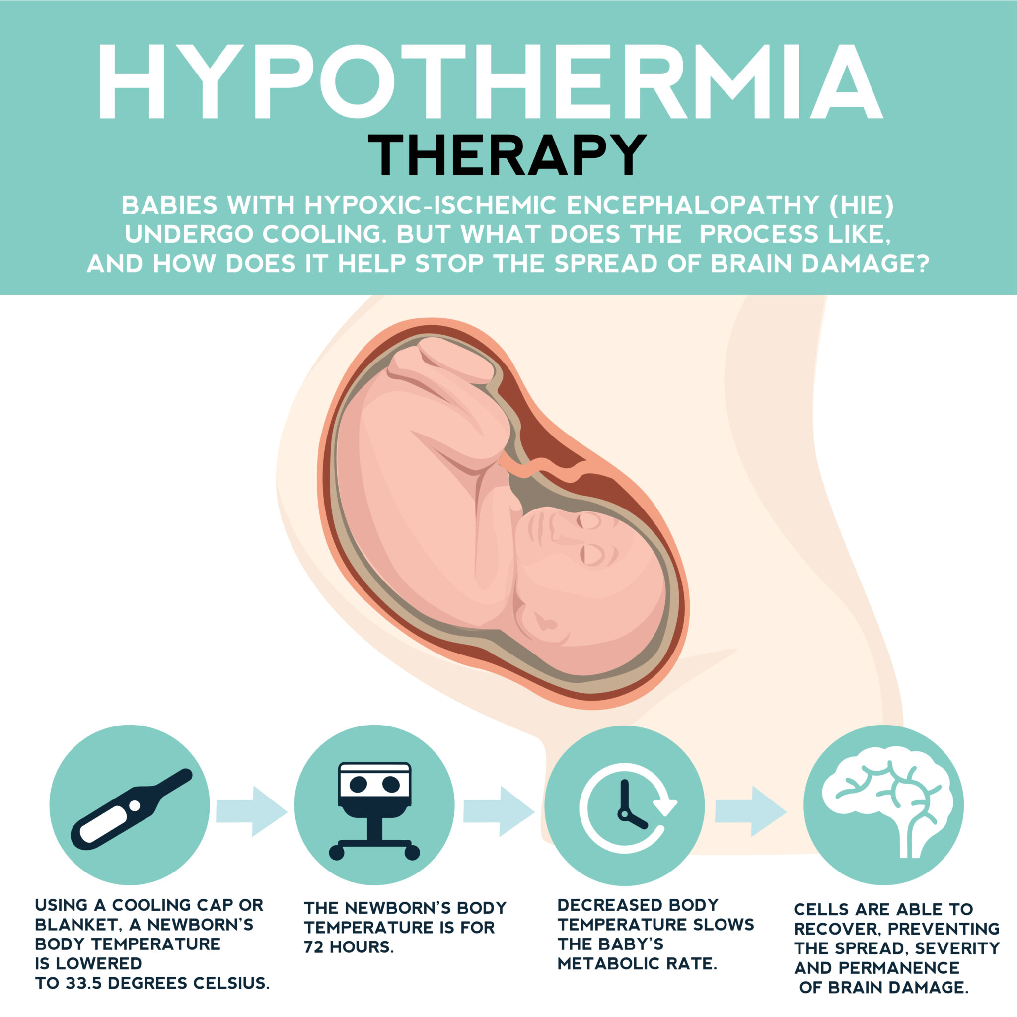 hypothermia therapy