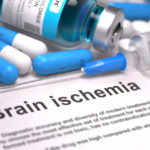 infant brain ischemia