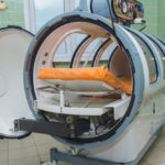 hyperbaric oxygen therapy