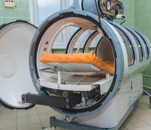 hyperbaric oxygen therapy