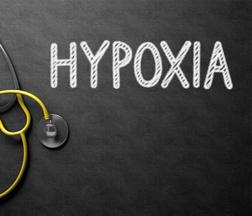 perinatal hypoxia