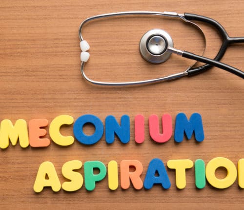 meconium aspiration syndrome