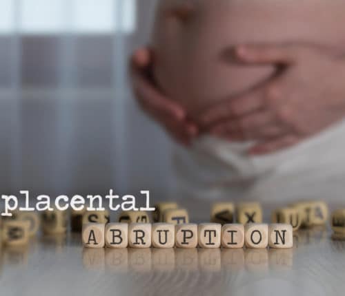 placental abruption