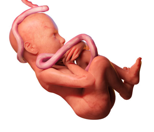 umbilical cord compression