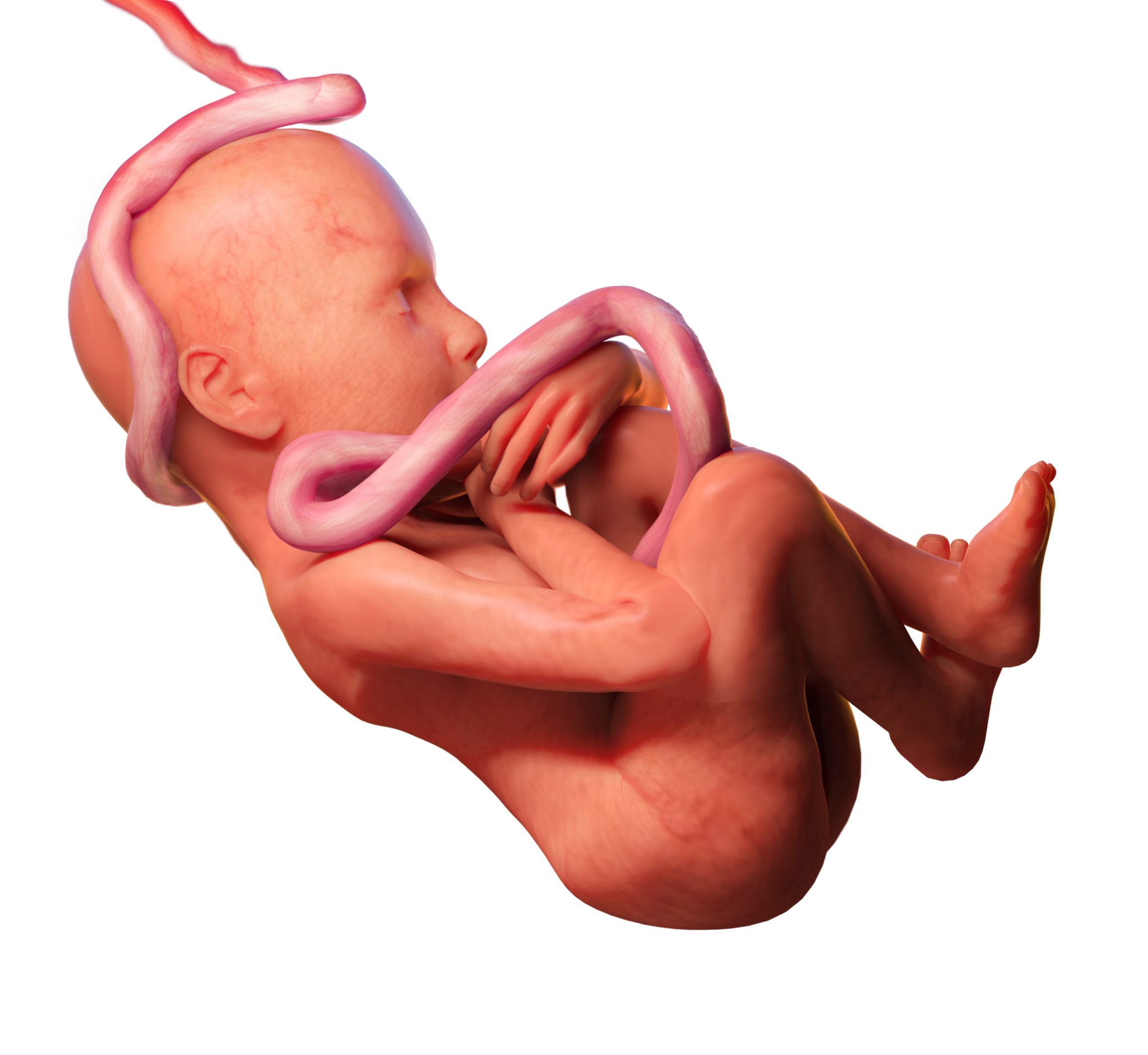 https://www.birthinjuryguide.org/wp-content/uploads/2021/01/Umbilical-scaled.jpg