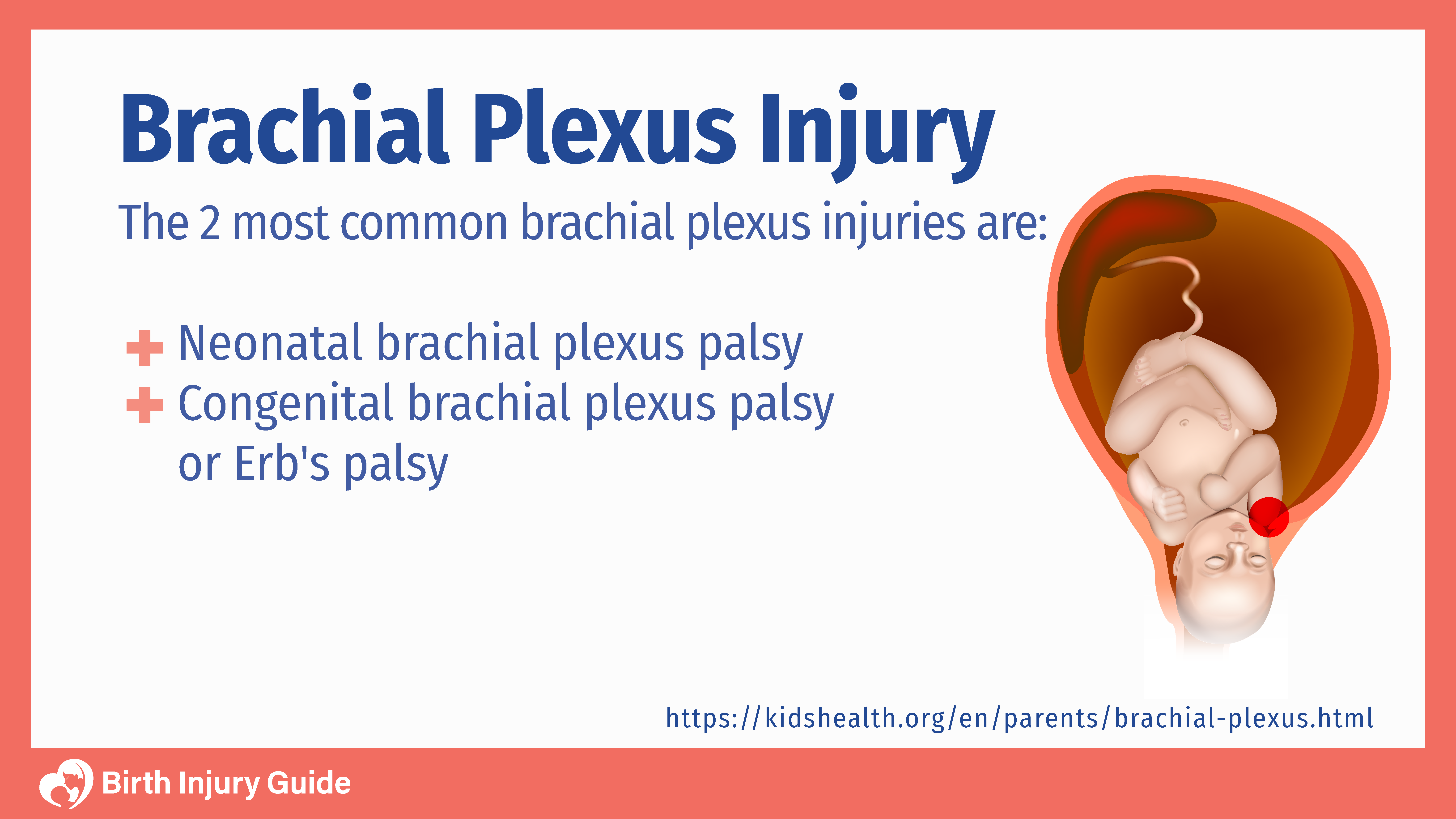 brachial plexus injury