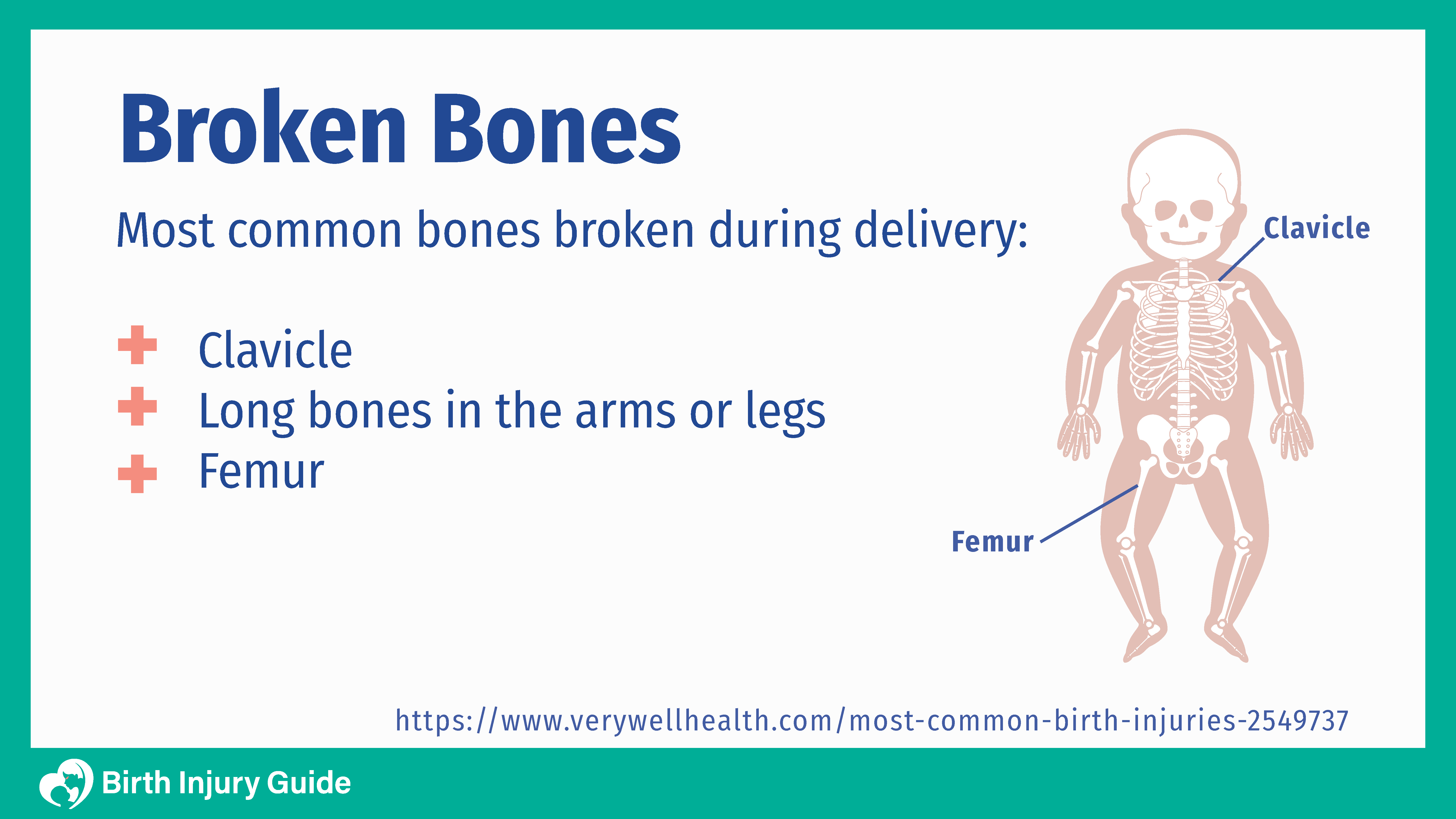 infant broken bones