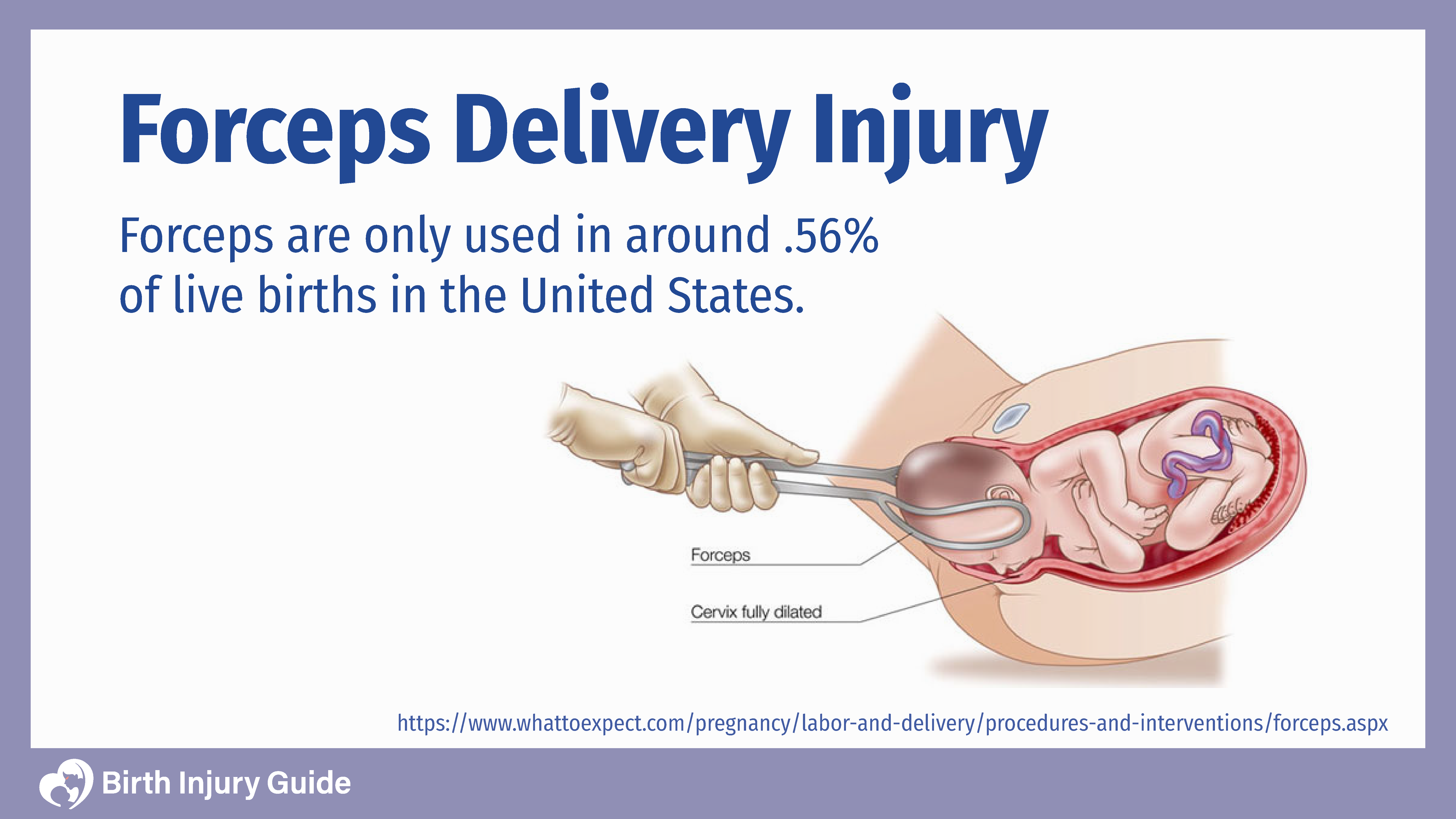 baby during forceps delivery injured