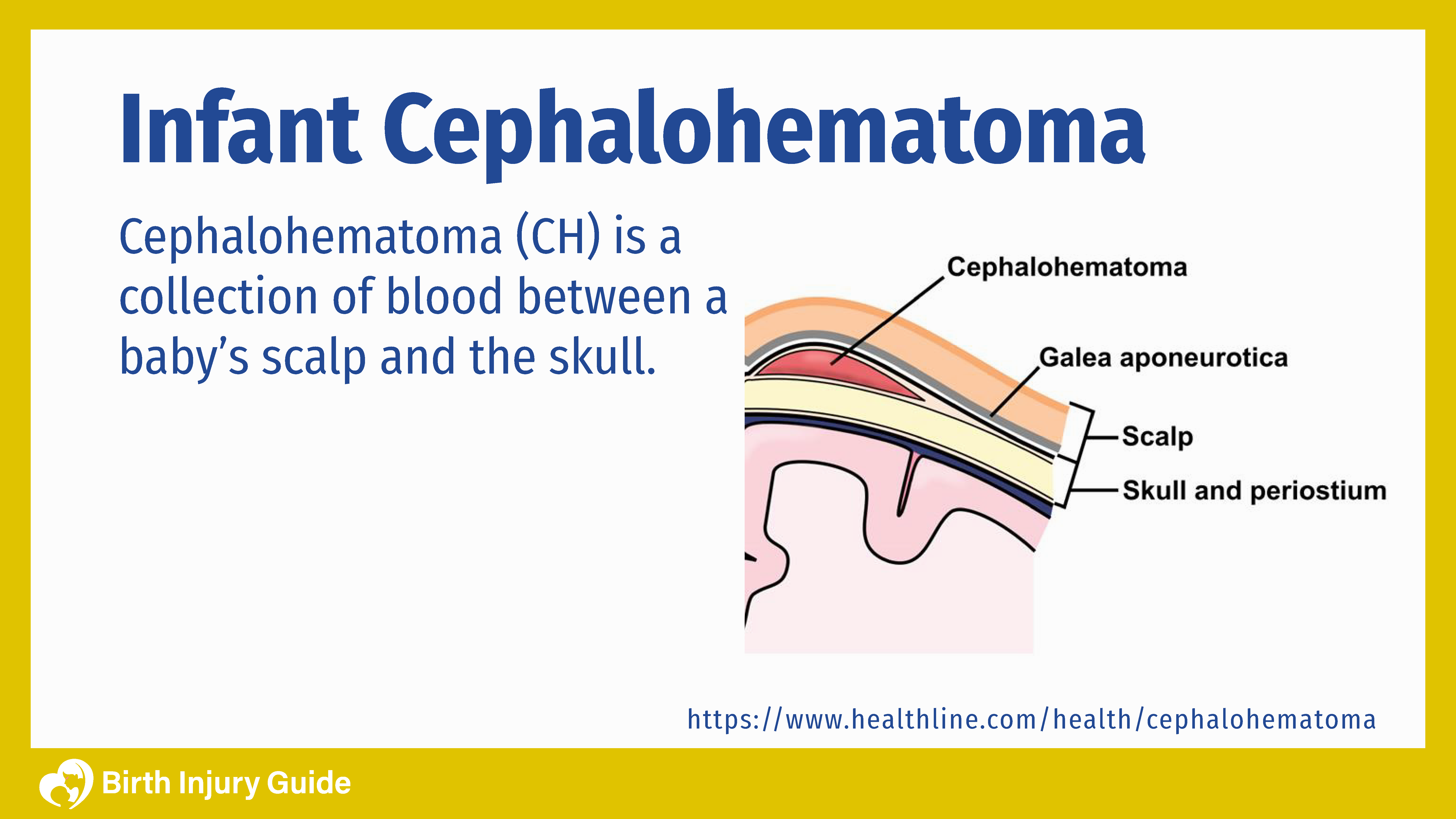 Infant Cephalohematoma Causes Treatment And Prevention