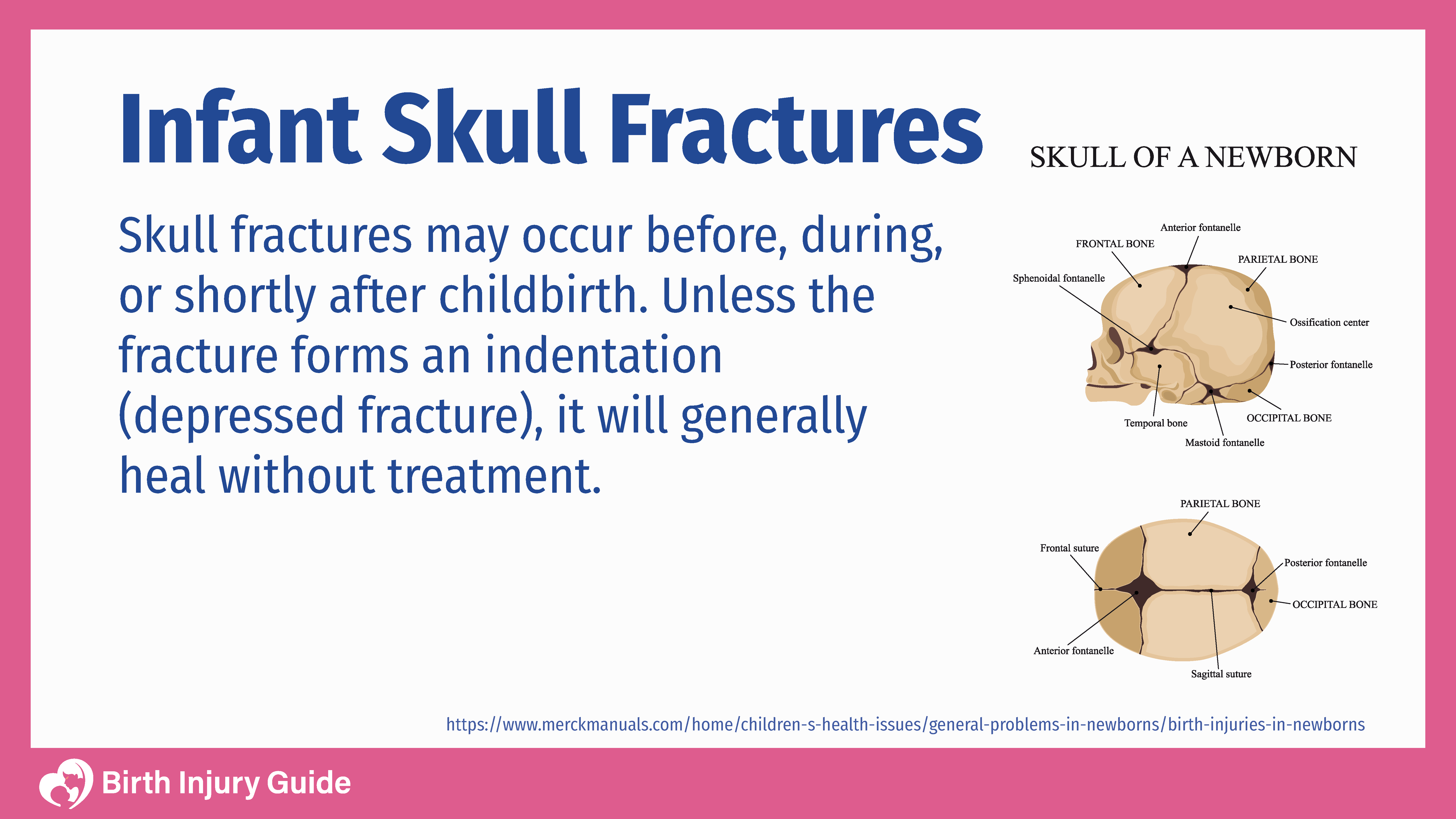 infant skull fractures