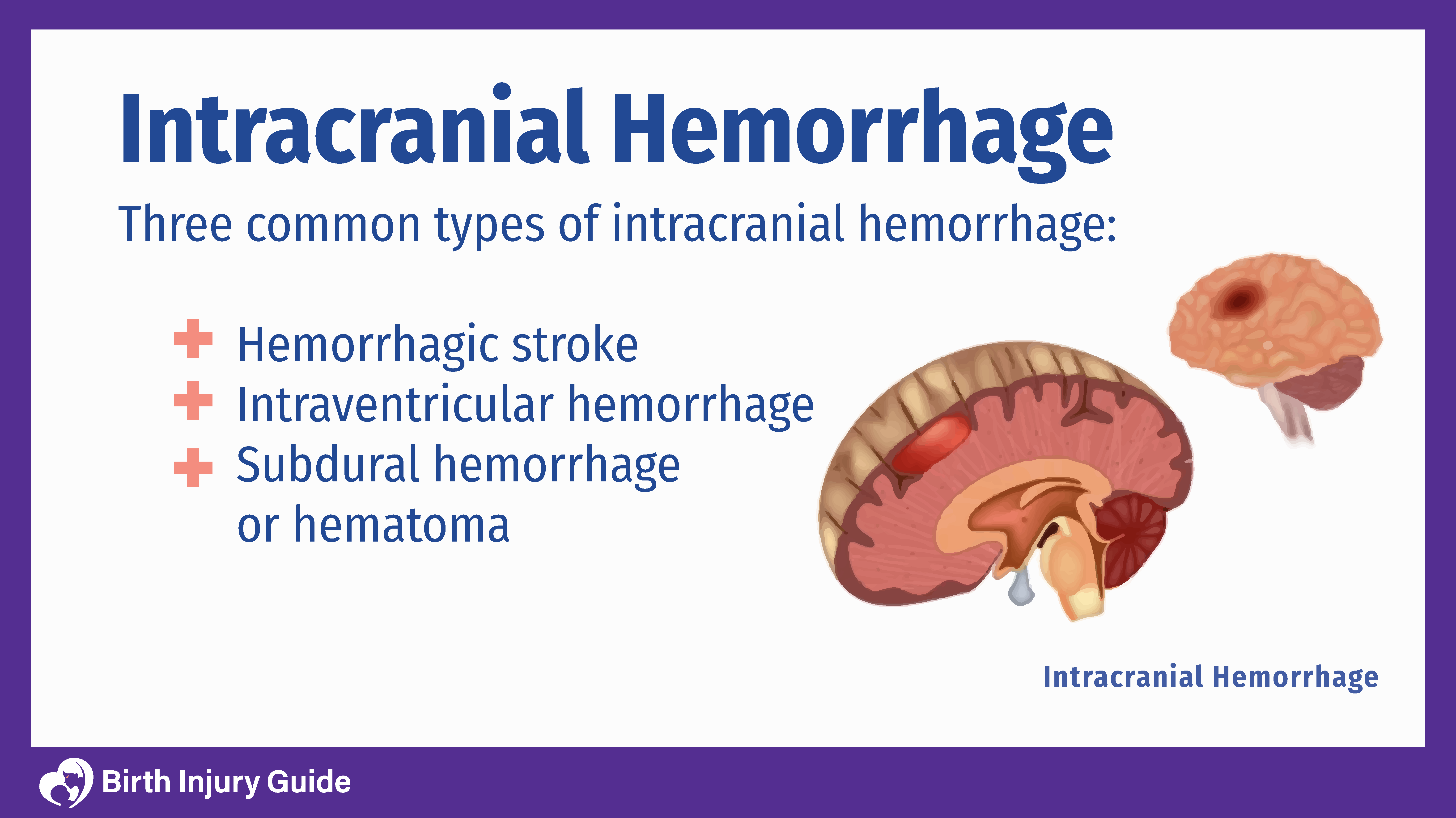 intracranial hemorrhage