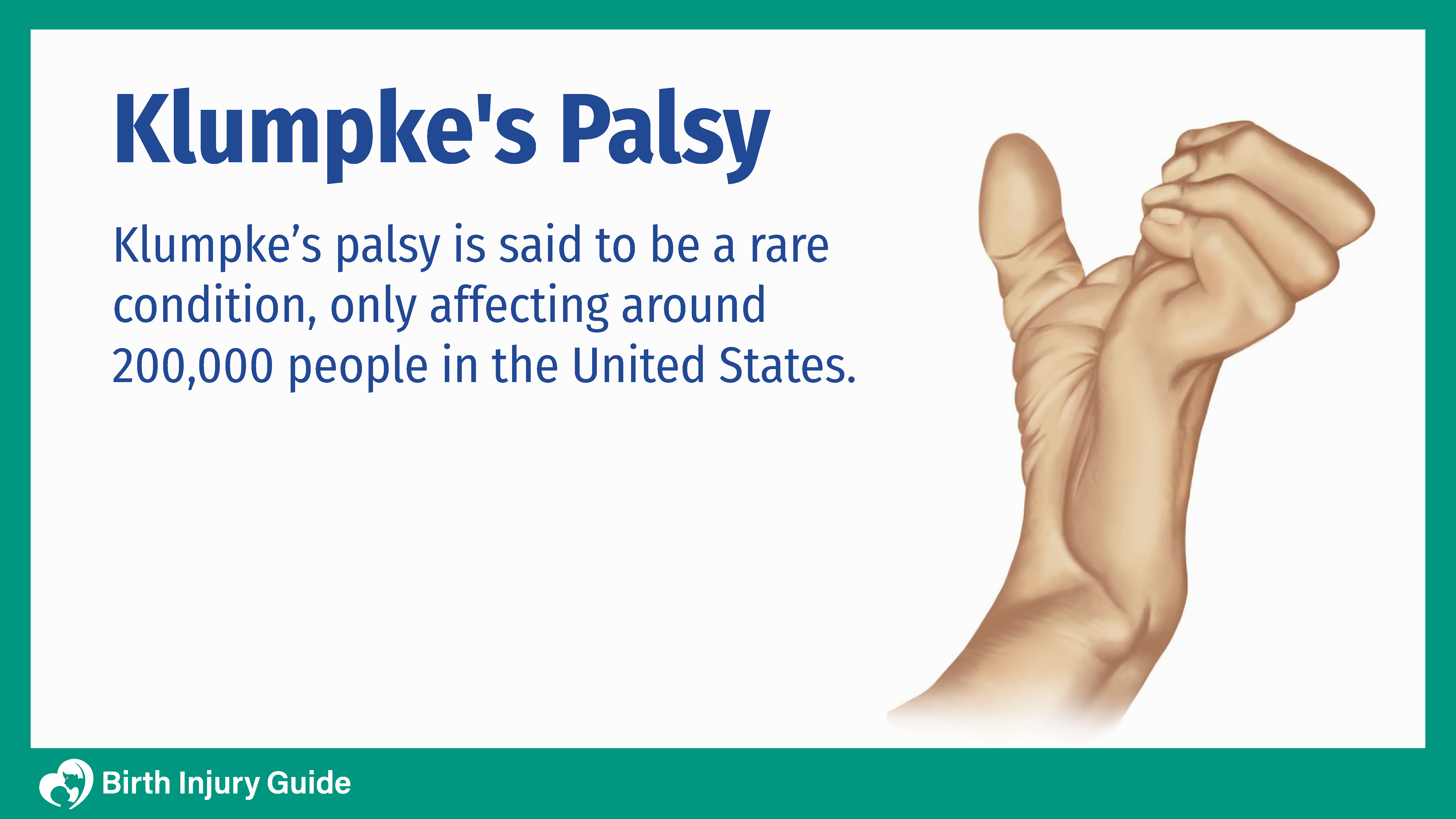 Klumpke's palsy