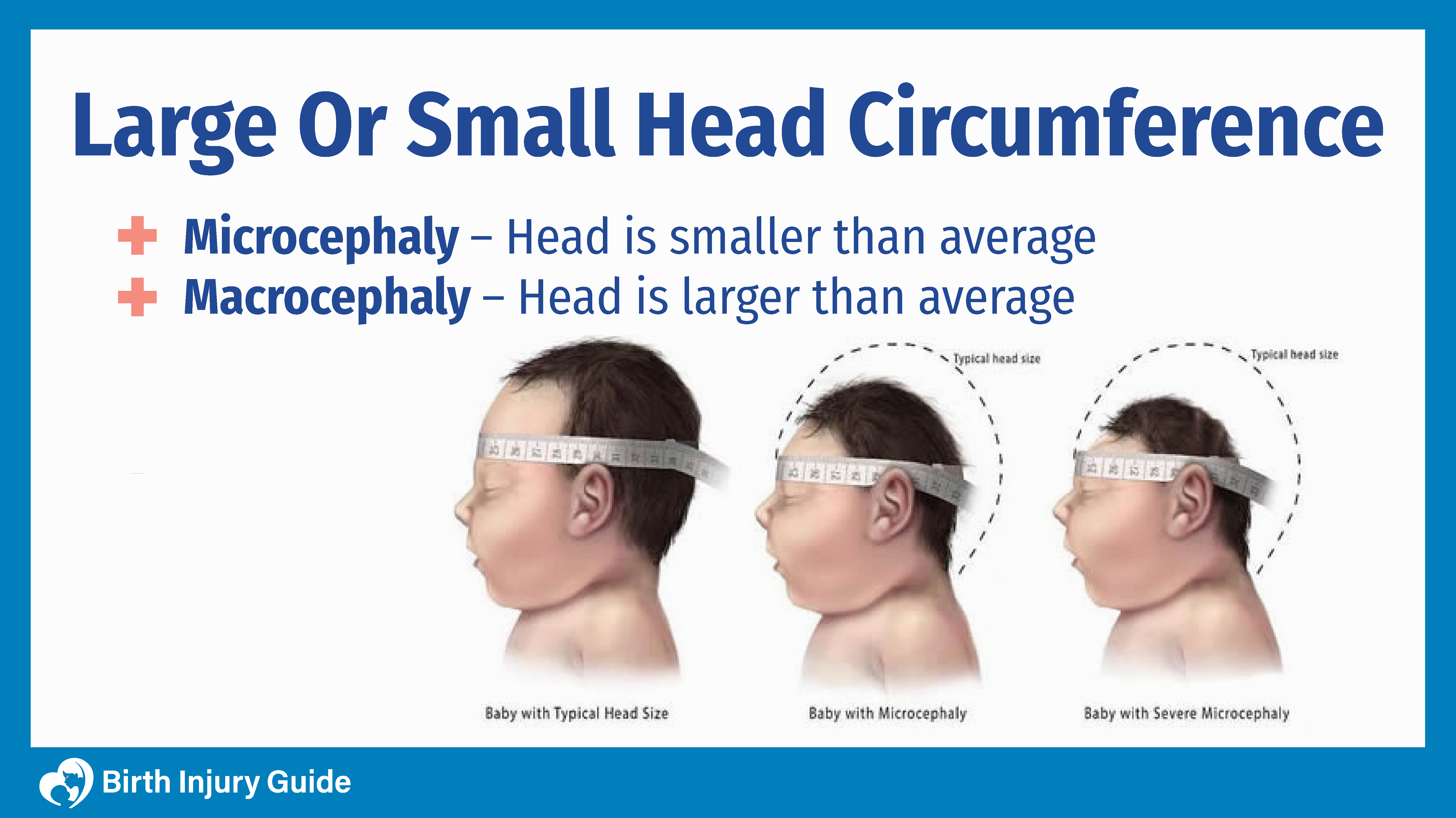 Head Birth Injury Circumference - Large Small Guide or