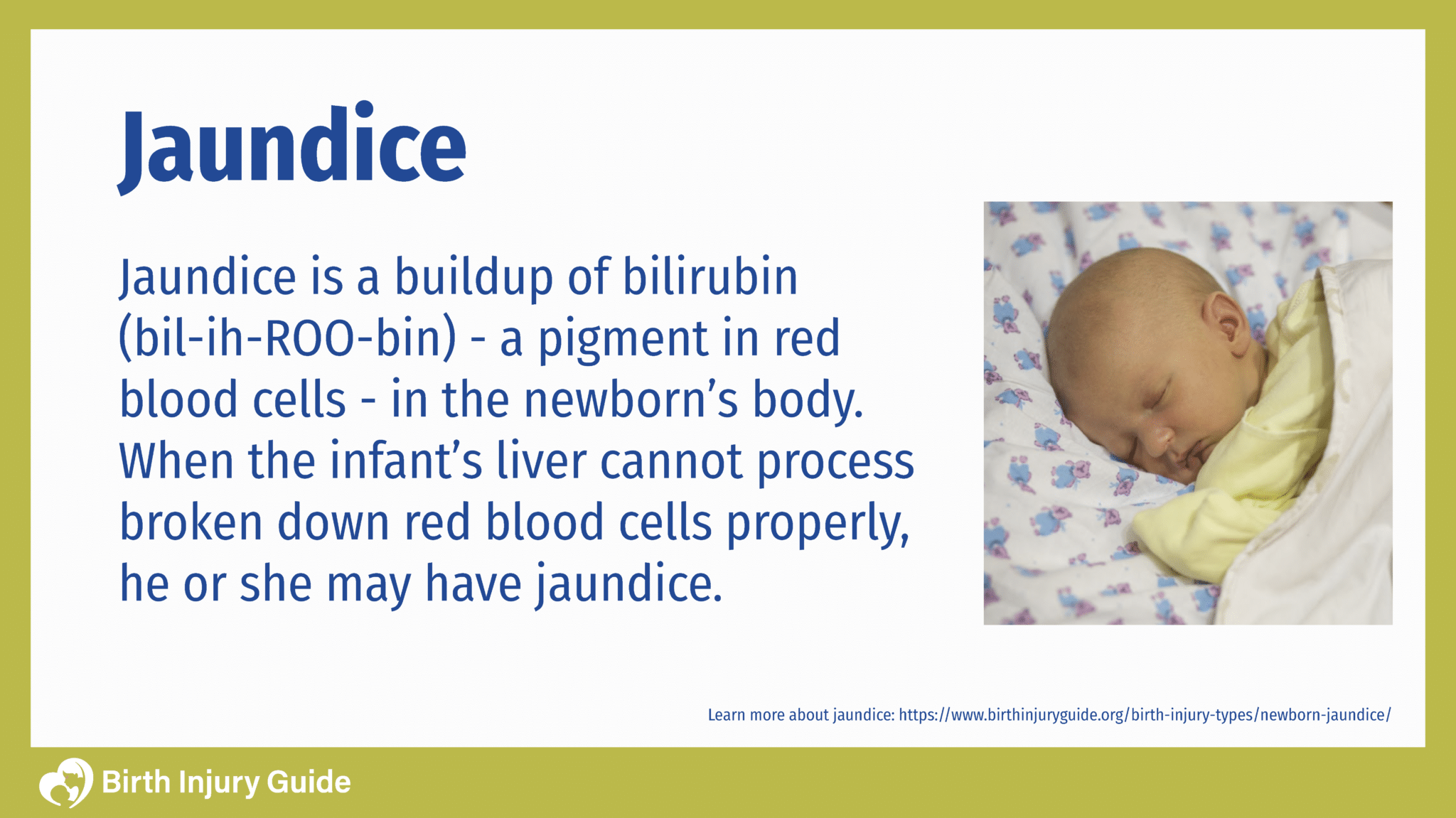 baby with jaundice and its description