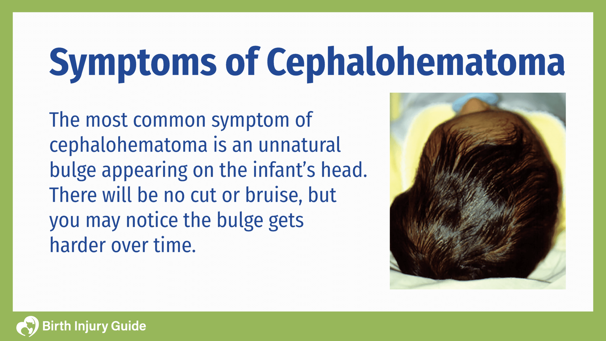 newborn baby with cephalohematoma