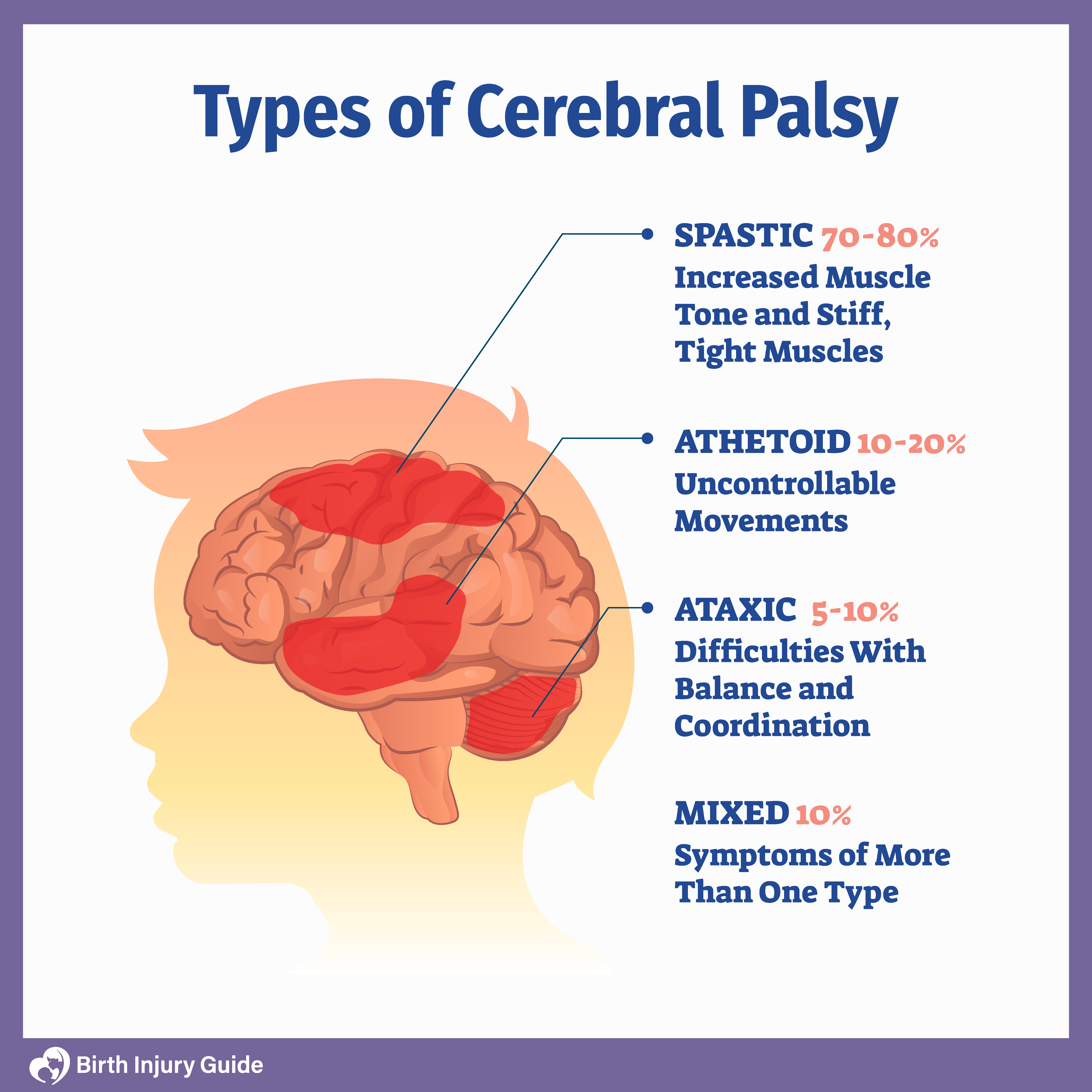 the different types of Cerebral Palsy; spastic, athetoid, ataxic, mixed. Brain affected areas by cerebral palsy.