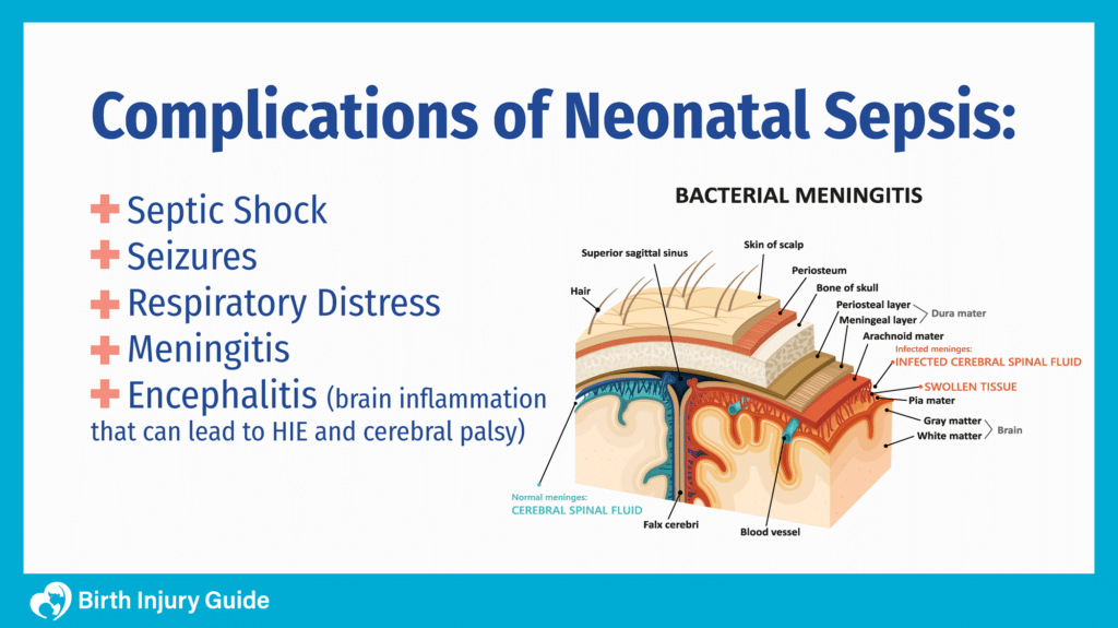 complications of neonatal sepsis