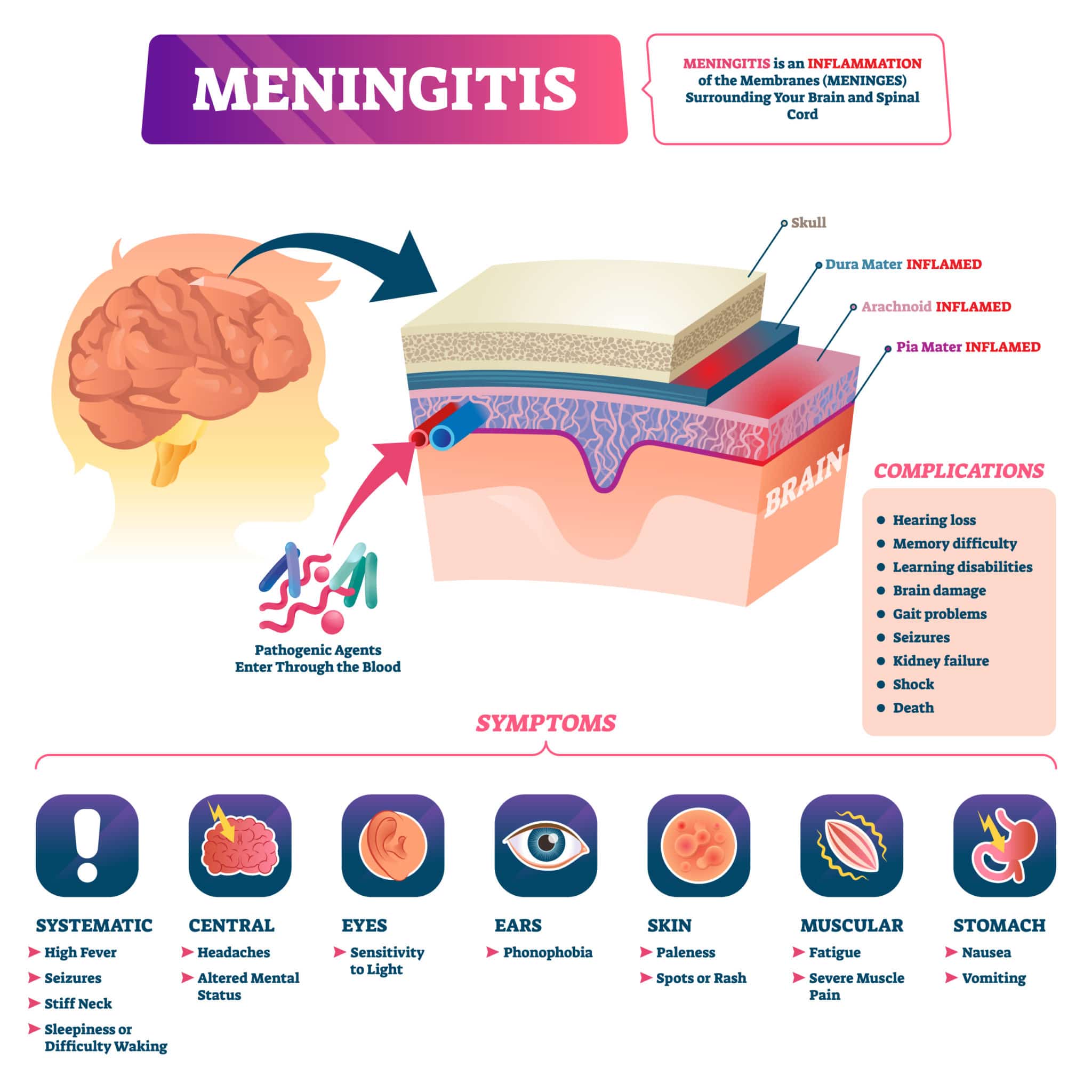 what is meningitis?