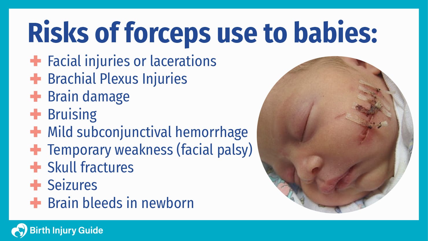 risk of forceps to babies