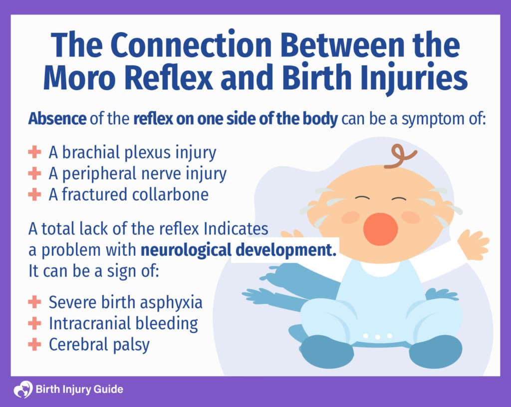 Are Birth Asphyxia and Moro Reflex Related? Birth Injury Guide