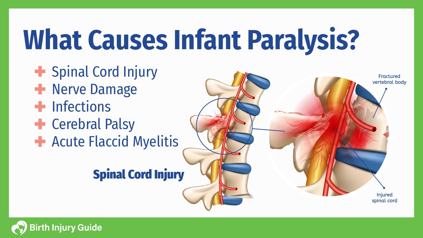 what causes infant paralysis?