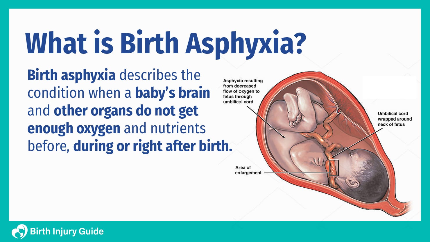 what is birth asphyxia?