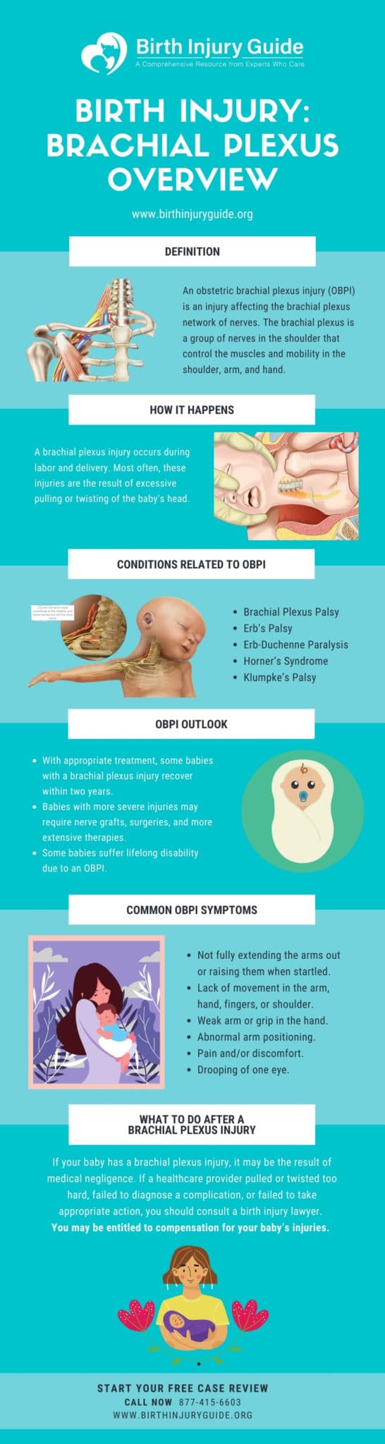 birth injury: brachial plexus